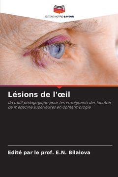 portada Lésions de l'oeil (in French)