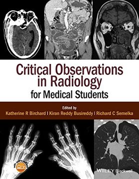 portada Critical Observations in Radiology for Medical Students (en Inglés)