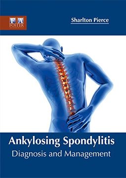 portada Ankylosing Spondylitis: Diagnosis and Management