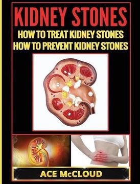 portada Kidney Stones: How To Treat Kidney Stones: How To Prevent Kidney Stones