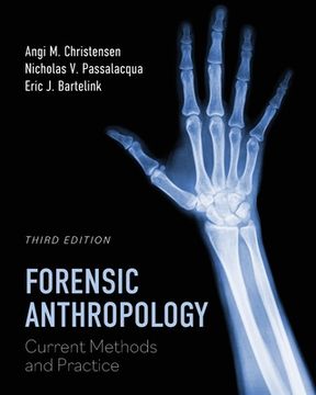 portada Forensic Anthropology: Current Methods and Practice