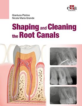 portada Shaping and Cleaning the Root Canals 