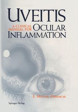 portada uveitis: a clinical manual for ocular inflammation (in English)