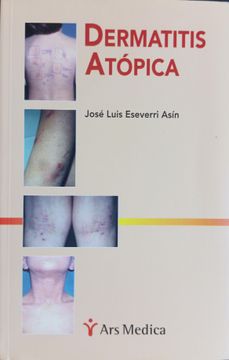 Dermatitis Atopica (in Spanish)