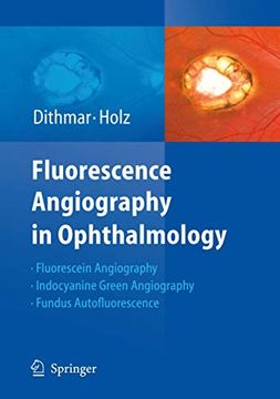 portada Fluorescence Angiography in Ophthalmology (en Inglés)