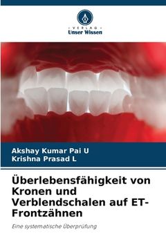 portada Überlebensfähigkeit von Kronen und Verblendschalen auf ET-Frontzähnen (en Alemán)