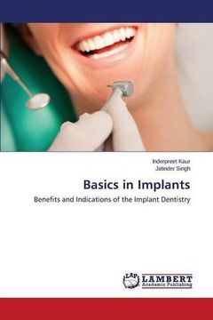 portada Basics in Implants