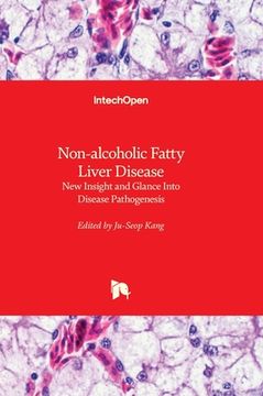 portada Non-alcoholic Fatty Liver Disease - New Insight and Glance Into Disease Pathogenesis (en Inglés)