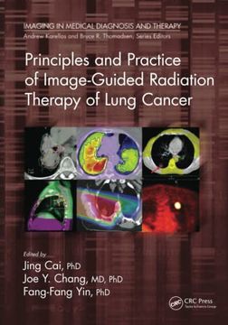 portada Principles and Practice of Image-Guided Radiation Therapy of Lung Cancer (Imaging in Medical Diagnosis and Therapy) (en Inglés)