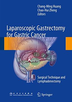 portada Laparoscopic Gastrectomy for Gastric Cancer: Surgical Technique and Lymphadenectomy