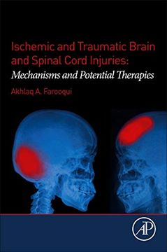 portada Ischemic and Traumatic Brain and Spinal Cord Injuries: Mechanisms and Potential Therapies (en Inglés)