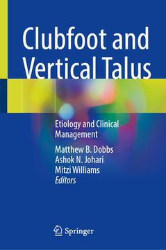 portada Clubfoot and Vertical Talus: Etiology and Clinical Management (en Inglés)