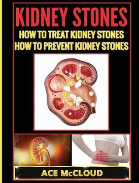 portada Kidney Stones: How To Treat Kidney Stones: How To Prevent Kidney Stones (Kidney Stone Treatment & Prevention Guide With All)