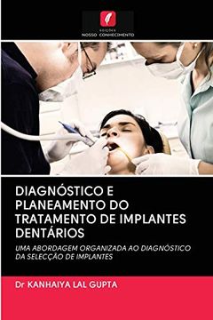 portada Diagnóstico e Planeamento do Tratamento de Implantes Dentários: Uma Abordagem Organizada ao Diagnóstico da Selecção de Implantes (en Portugués)