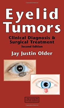portada Eyelid Tumors (en Inglés)
