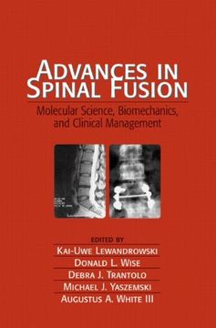 portada Advances in Spinal Fusion: Molecular Science, Biomechanics, and Clinical Management (en Inglés)