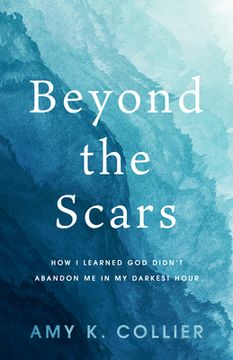 portada Beyond the Scars: How I Learned God Didn't Abandoned Me in My Darkest Hour (en Inglés)