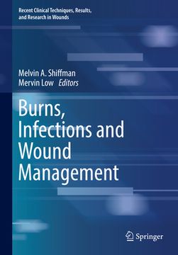portada Burns, Infections and Wound Management (en Inglés)