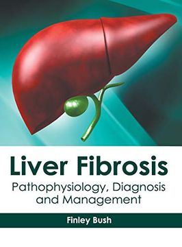 portada Liver Fibrosis: Pathophysiology, Diagnosis and Management (en Inglés)
