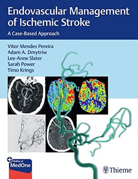 portada Endovascular Management of Ischemic Stroke: A Case-Based Approach (en Inglés)