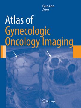 portada Atlas of Gynecologic Oncology Imaging (en Inglés)