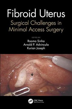 portada Fibroid Uterus: Surgical Challenges in Minimal Access Surgery (en Inglés)