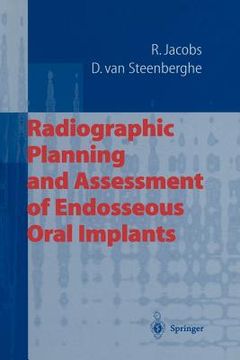 portada radiographic planning and assessment of endosseous oral implants (in English)