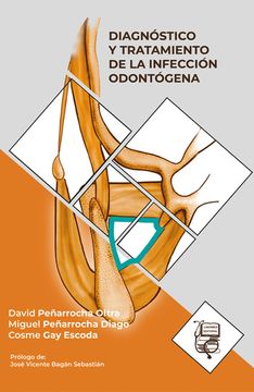 portada Diagnóstico y Tratamiento de la Infección Odontógena