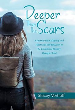 portada Deeper Than the Scars: A Journey From Cleft lip and Palate and Self-Rejection to Re-Established Identity Through Christ (en Inglés)