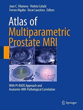 portada Atlas of Multiparametric Prostate MRI: With Pi-Rads Approach and Anatomic-Mri-Pathological Correlation (en Inglés)