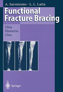 portada Functional Fracture Bracing: Tibia, Humerus, and Ulna (en Inglés)