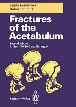 portada Fractures of the Acetabulum