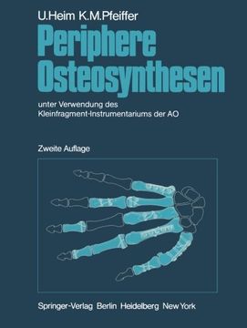 portada Periphere Osteosynthesen: unter Verwendung des Kleinfragment-Instrumentariums der AO (German Edition)