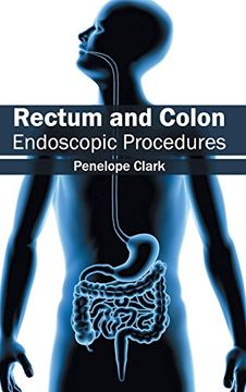 portada Rectum and Colon: Endoscopic Procedures 