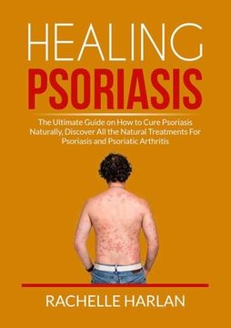 portada Healing Psoriasis: The Ultimate Guide on How to Cure Psoriasis Naturally, Discover All the Natural Treatments For Psoriasis and Psoriatic (en Inglés)