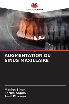 portada Augmentation Du Sinus Maxillaire (en Francés)