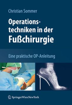 portada Operationstechniken in Der Fußchirurgie: Eine Praktische Op-Anleitung