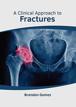 portada A Clinical Approach to Fractures (en Inglés)
