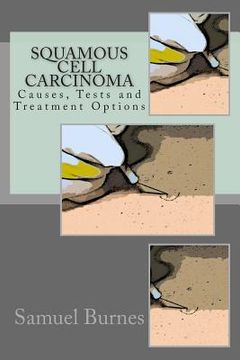 portada Squamous Cell Carcinoma: Causes, Tests and Treatment Options (en Inglés)