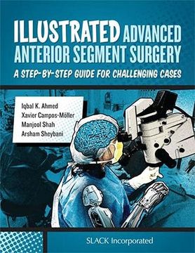 portada Illustrated Advanced Anterior Segment Surgery: A Step-By-Step Guide for Challenging Cases 