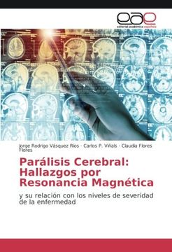 portada Parálisis Cerebral: Hallazgos por Resonancia Magnética: y su relación con los niveles de severidad de la enfermedad (Spanish Edition)