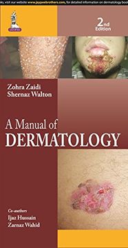 portada A Manual of Dermatology (en Inglés)