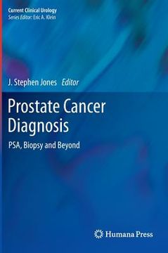 portada prostate cancer diagnosis: psa, biopsy and beyond (en Inglés)