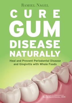 portada Cure Gum Disease Naturally: Heal and Prevent Periodontal Disease and Gingivitis with Whole Foods
