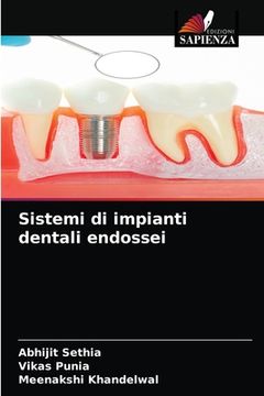 portada Sistemi di impianti dentali endossei (en Italiano)