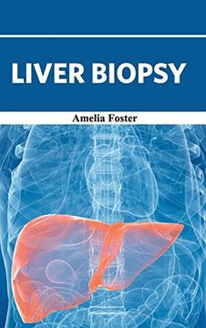 portada Liver Biopsy (en Inglés)