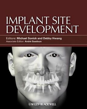 portada Implant Site Development 