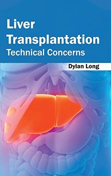 portada Liver Transplantation: Technical Concerns 