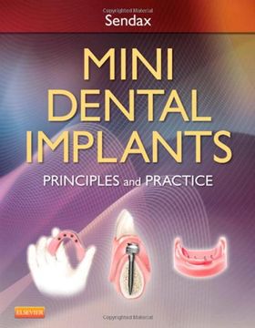 portada mini dental implants: principles and practice (en Inglés)