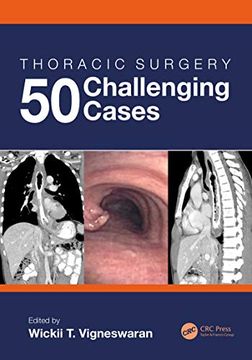 portada Thoracic Surgery: 50 Challenging Cases: 50 Challenging Cases: (en Inglés)